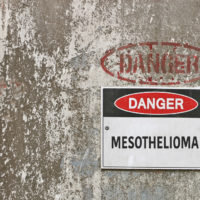 Mesothelioma sign