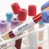 STD test blood analysis collection tube selected by technician. Serial number is random, labels and document are fictitious and created by the photographer.